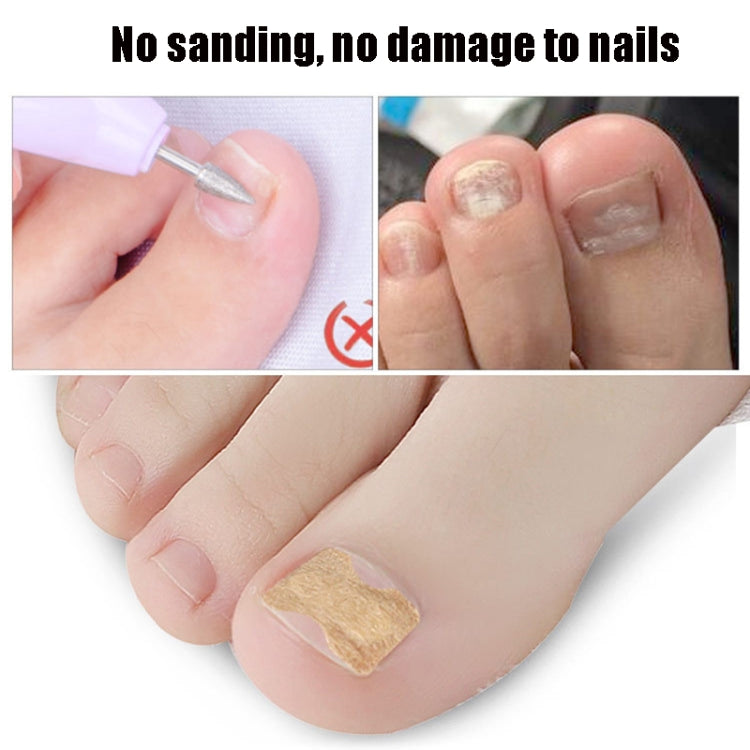 10 PCS Glue-free Orthopedic Nail Stick Toe Nail Groove Inlay Corrector