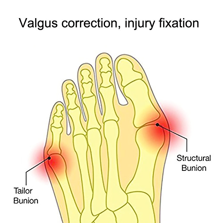 1 Pairs Wearable Shoes Big Toe Valgus Corrector Toe Comfortable Splitter