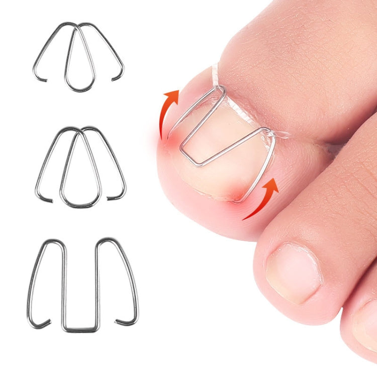 6pcs /Box Ortho Wire Nail Insertion Orthotic Toe Nail Ortho Hooks