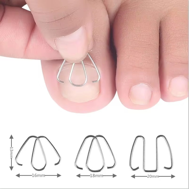 6pcs /Box Ortho Wire Nail Insertion Orthotic Toe Nail Ortho Hooks